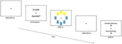 Loss Aversion Reflects Information Accumulation, Not Bias: A Drift-Diffusion Model Study